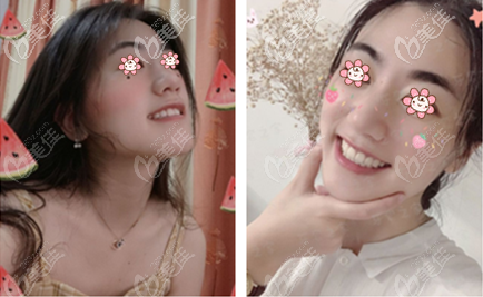 劉利軍醫(yī)生矯牙真的還可以 劉利軍醫(yī)生矯牙真的還可以