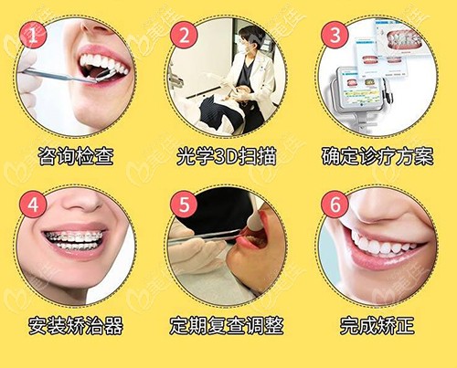 陶瓷托槽矯正過程