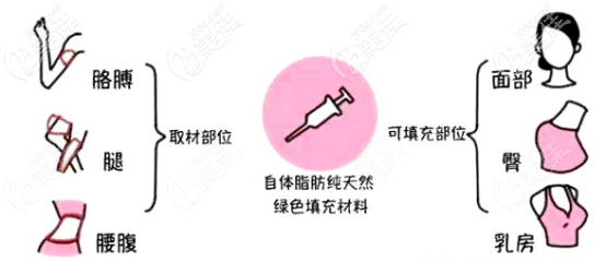 脂肪可以填充的部位 脂肪可以填充的部位