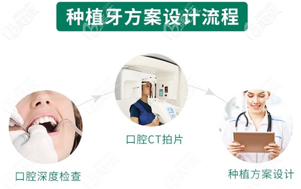 種植牙方案設(shè)計(jì)流程