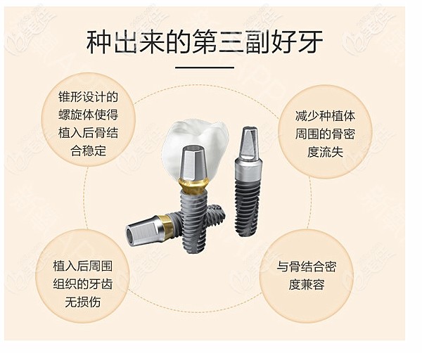 大連牙元素口腔的種植牙幫你種植