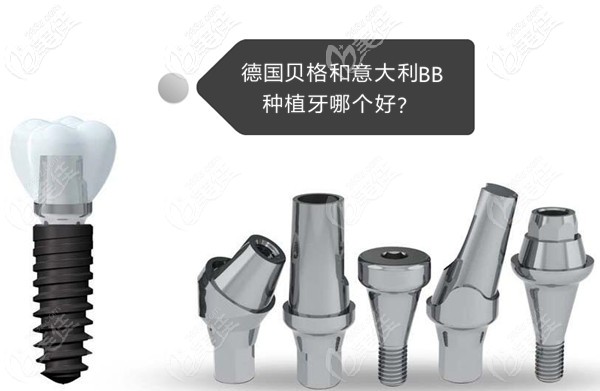 德國(guó)貝格和意大利BB種植牙哪個(gè)好 德國(guó)貝格和意大利BB種植牙哪個(gè)好