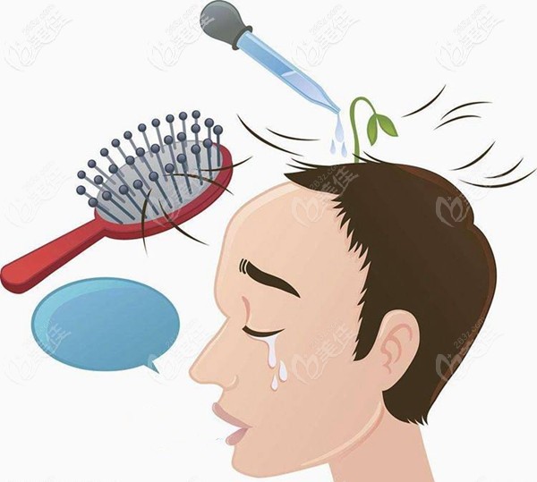 90后已加入脫發(fā)大軍