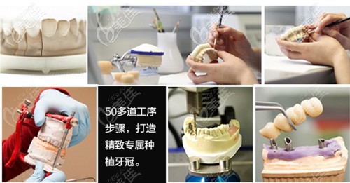 長(zhǎng)春超龍牙博士即刻美學(xué)修復(fù)