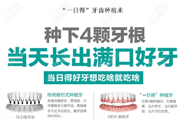 眾派一日得牙齒種植技術特點