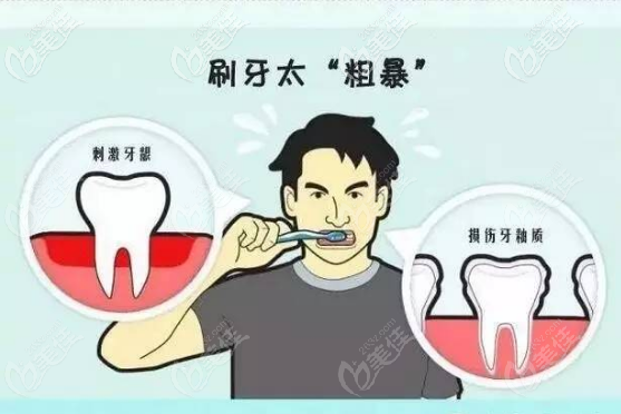 認(rèn)真刷牙避免楔狀缺損