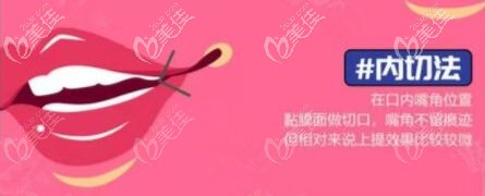 嘴角上揚術(shù)內(nèi)切術(shù)式