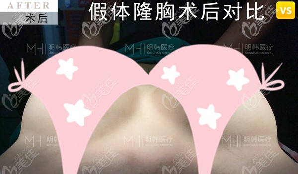 20201126_1606378361900331.jpg 2.jpg