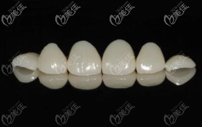 全瓷牙貼面材料