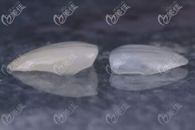 樹脂牙貼面材料