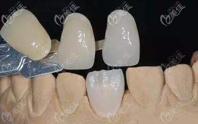 硬質(zhì)牙面材料