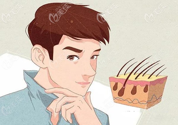 頭發(fā)種植術后效果示意圖