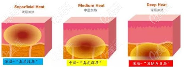 熱拉提的作用層次