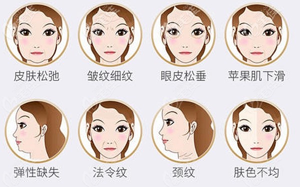 熱拉提改善肌膚