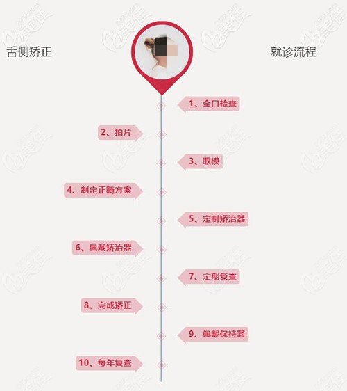 舌側矯正就診流程