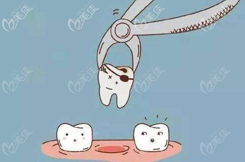 牙齒矯正要拔牙嗎 牙齒矯正要拔牙嗎