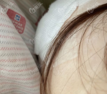 乳暈貼著紗布的樣子 乳暈貼著紗布的樣子