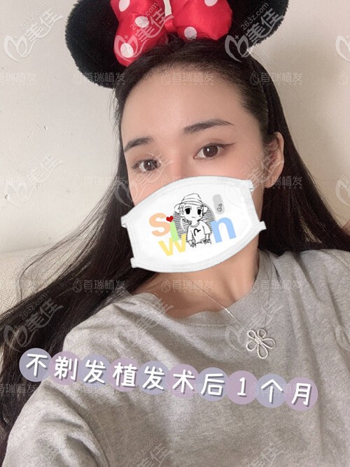 毛發(fā)移植術(shù)親身經(jīng)歷:速來圍觀杭州首瑞的不剃發(fā)長發(fā)發(fā)際線種植技術(shù)怎么樣吧!