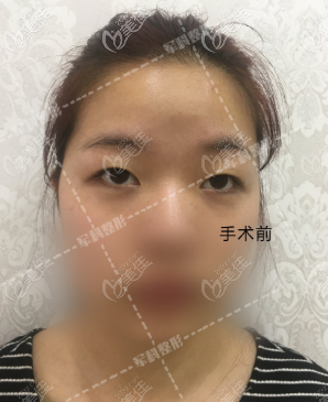 原來(lái)我單眼皮 原來(lái)我單眼皮