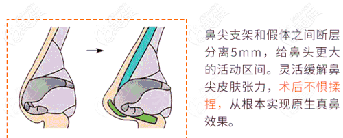 20201201_1606811846506690.gif b624638ccfc44995adb51cef52acb362_570_副本.gif