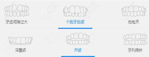 美立刻矯正適用范圍