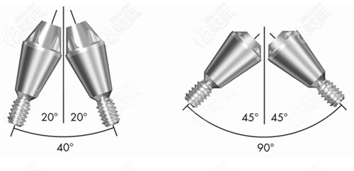 瑞典astra種植體 瑞典astra種植體