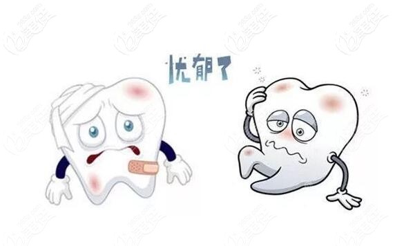 牙周炎的表現(xiàn)