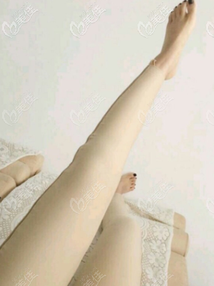 我在北京星燦宮做大腿吸脂有半個多月了 我在北京星燦宮做大腿吸脂有半個多月了