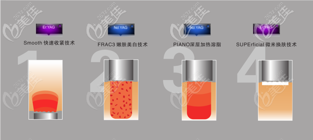 歐洲之星Fotona 4D pro一款緊膚抗衰儀器