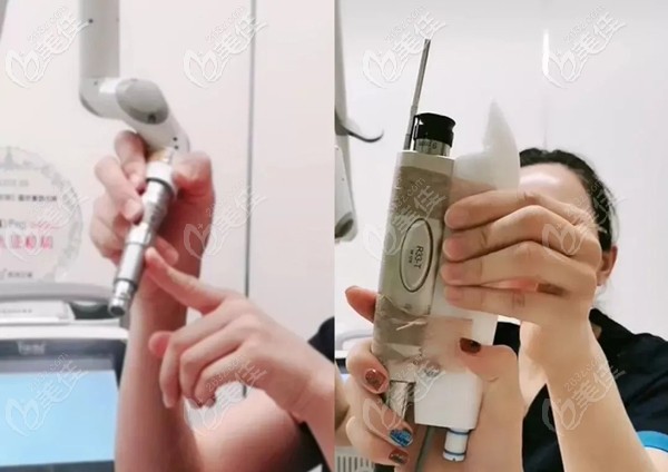 Fotona 4Dpro2940治療頭