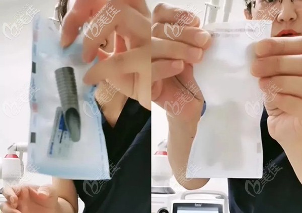 Fotona 4Dpro1064治療頭