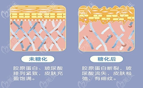 皮膚糖化和未糖化的區(qū)別