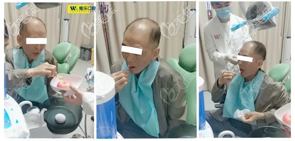 帶上臨時牙冠當(dāng)場試吃蘋果無壓力 帶上臨時牙冠當(dāng)場試吃蘋果無壓力