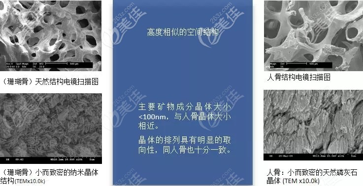 珊瑚骨和人骨比較相似的空間結(jié)構(gòu)
