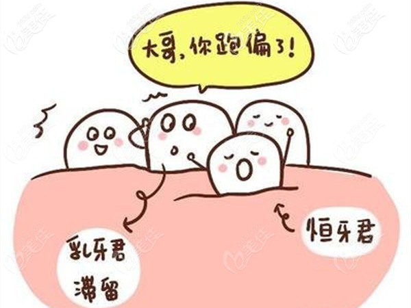 可以采用mrc矯正牙列不齊的情況