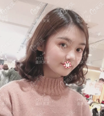 一個(gè)月后的樣子我已經(jīng)很喜歡了