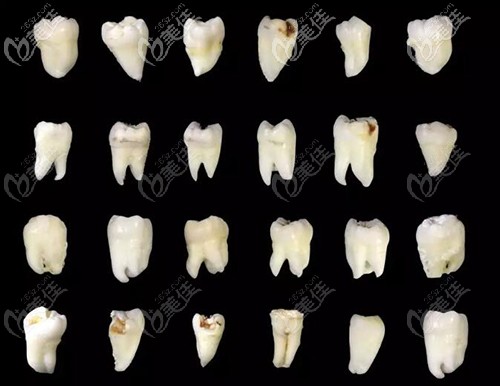 形狀不一的智齒