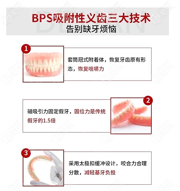 北京國貿(mào)佳美口腔做吸附性義齒的優(yōu)勢