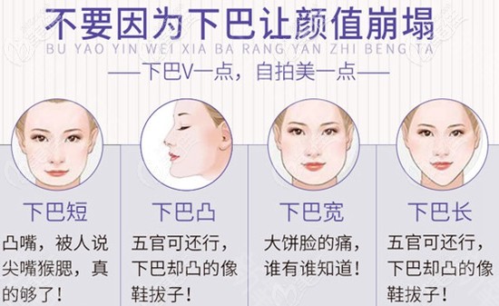 買它買它!廣州韓后整形韓式生科隆下巴6800元起的價格真是優(yōu)惠到心坎里了!