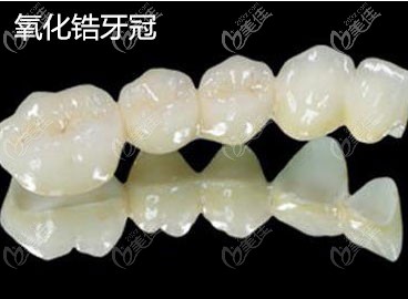 合眾口腔年末氧化鋯牙冠有優(yōu)惠
