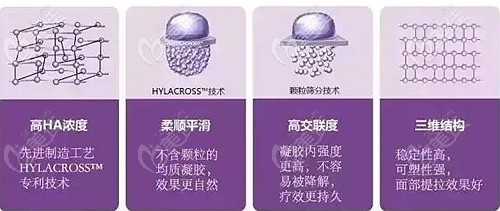 喬雅登玻尿酸維持時(shí)間更長(zhǎng)