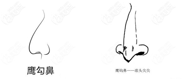 鷹鉤鼻形狀 鷹鉤鼻形狀