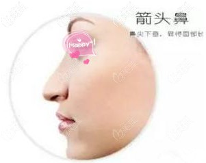 箭頭鼻形狀 箭頭鼻形狀