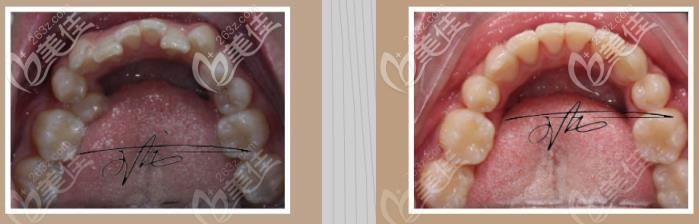 前后對比是不是很明顯呢 前后對比是不是很明顯呢