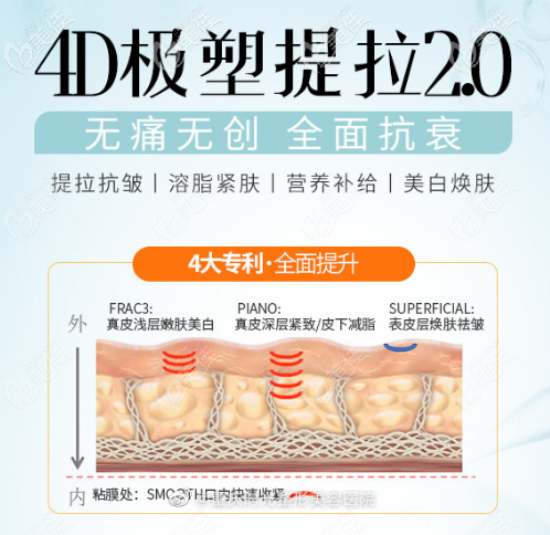 歐洲之星4d抗衰效果怎么樣