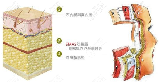 PSV面部提升層次示意圖