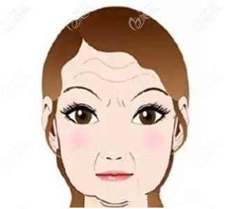 松弛的面部肌膚示意圖