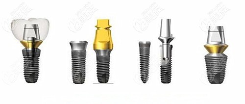 韓國dio種植體系統(tǒng)