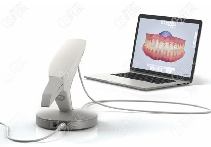 3D口掃矯正 3D口掃矯正