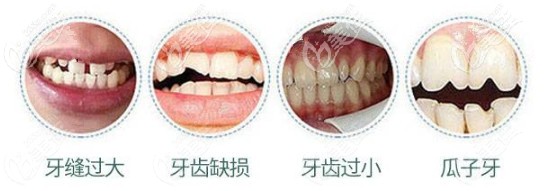 牙齒不美觀癥狀